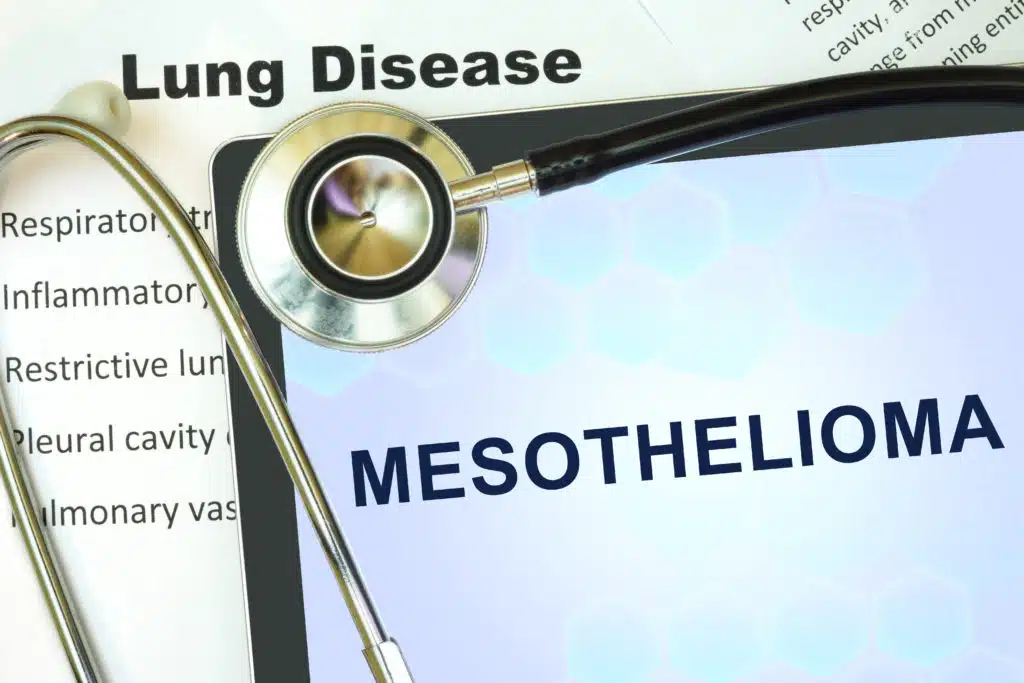 What are Signs of Mesothelioma?