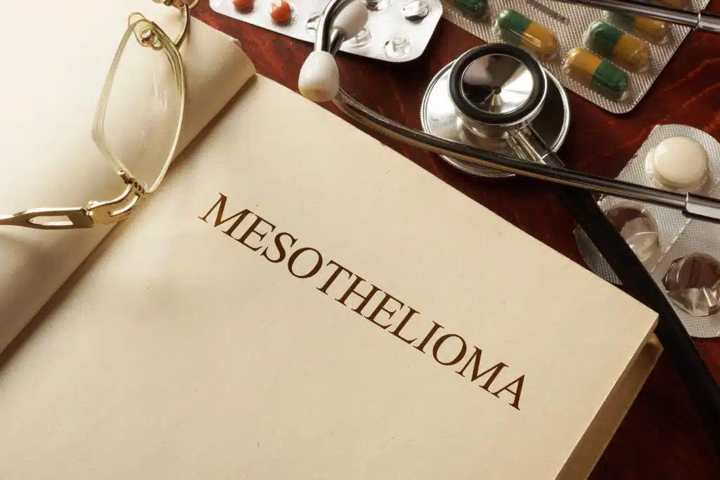 Who Can File a Mesothelioma Claim in New Jersey?